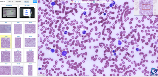DeepCell AI morphology cell map of a peripheral blood smear
